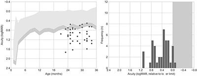 Visual Acuity alterations in heavily impaired Congenital Zika Syndrome (CZS) children